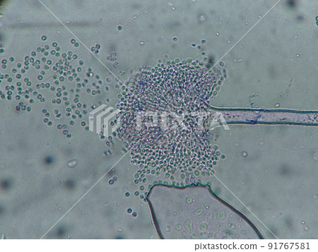 Mold releases spores 91767581