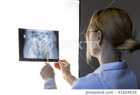 Osteotomy of the femur. The doctor examines the X-ray picture before the operation. Focus on X-ray. 91804638