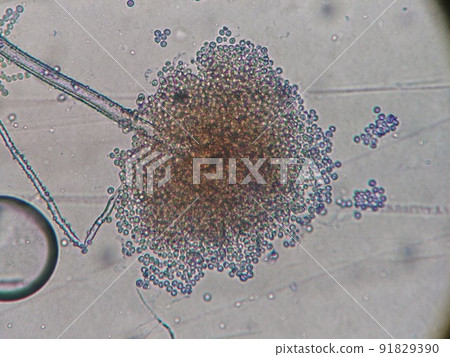 Enlarged micrograph of mold spores Enlarged micrograph of mold spores 91829390