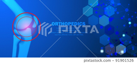 injection, knee, x-ray 91901526