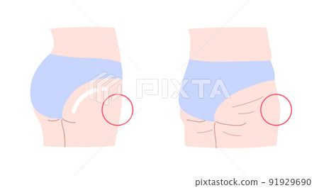 緊實臀部和下垂臀部的插圖集 91929690