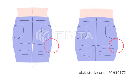 Illustration set of raised buttocks and drooping buttocks 91930172