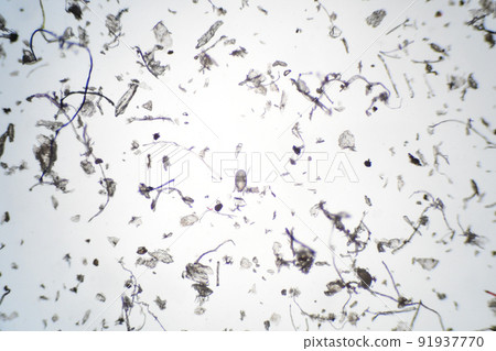 House dust and mites magnified with a microscope 91937770