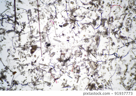 用顯微鏡放大的屋塵和蟎蟲 91937773