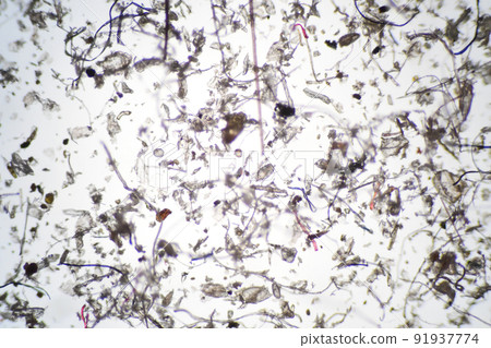 House dust and mites magnified with a microscope 91937774