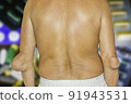 Severe gout in men suffering from joint pain, bone pain, gout, rheumatoid symptoms, radioactive sickness, ill man concept of male osteoporosis, injured bone, injury, pain, arthritis,arm, foot, knee 91943531