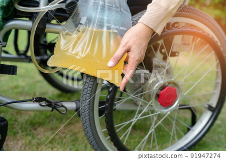 Asian lady woman patient sitting on wheelchair with urine bag in the hospital ward, healthy medical concept Asian lady woman patient sitting on wheelchair with urine bag in the hospital ward, healthy medical concept 91947274
