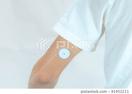 A man wearing a sensor for blood glucose monitoring on the back of his upper arm A man wearing a sensor for blood glucose monitoring on the back of his upper arm 91952211