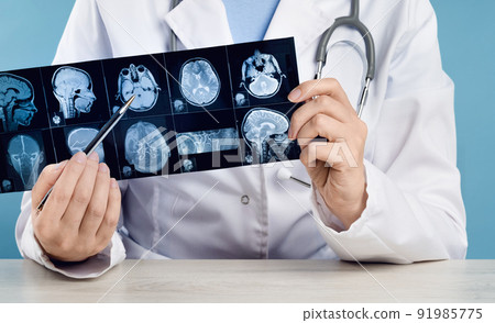 Female doctors hand pointing at x-ray medical imaging at a head checks 91985775