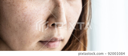 Middle-aged women with no makeup (cosmetology, skin, spots, chloasma) 92001084