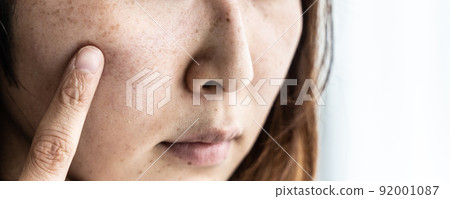 不化妝的中年女性（美容、皮膚、斑點、黃褐斑） 92001087