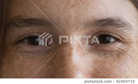 Freckled young woman looking at camera, cropped closeup face view 92004710