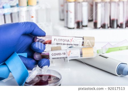 Doctor's hands hold blood samples of the new variant omicron plus flu FLORONA, covid19, coronavirus. Selective approach to the sample tube. 92017513