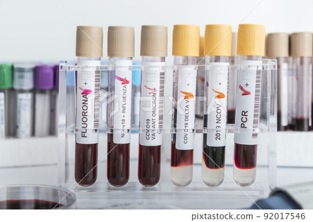 Blood samples of new variant OMICRON plus flu FLUORONA, covid19, coronavirus. Selective approach to the sample tube. 92017546