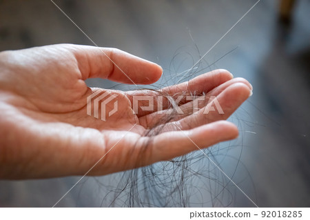 Hair loss concept. Hair loss concept. 92018285
