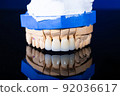 Frames of ceramic crowns on a gypsum model. Zirconia crowns. Metal-free ceramics at the manufacturing stage. Close-up, black isolate. 92036617