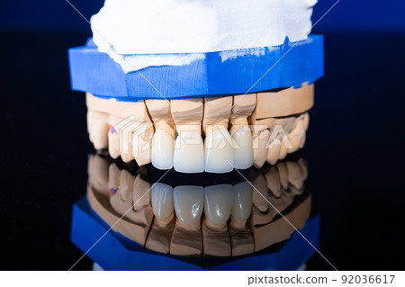 Frames of ceramic crowns on a gypsum model. Zirconia crowns. Metal-free ceramics at the manufacturing stage. Close-up, black isolate. Frames of ceramic crowns on a gypsum model. Zirconia crowns. Metal-free ceramics at the manufacturing stage. Close-up, black isolate. 92036617