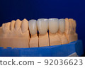 Frames of ceramic crowns on a gypsum model. Zirconia crowns. Metal-free ceramics at the manufacturing stage. Close-up, black isolate. 92036623