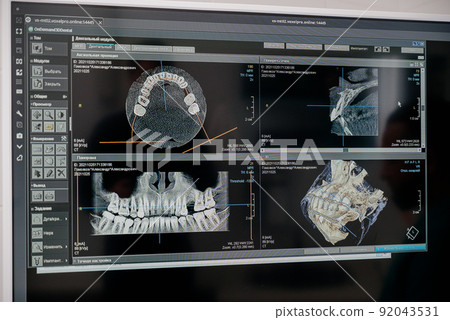 X-ray of the jaw with teeth on a computer monitor. Examination of the oral cavity using digital, medical equipment. Dental treatment in a dental clinic. 92043531