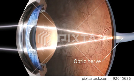 Eye Anatomy - Internal Structure, Medically Accurate 92045626