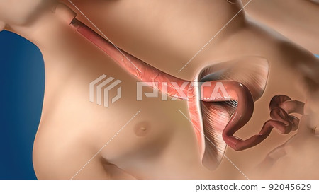 Medical of esophagus On Realistic Human Model 92045629