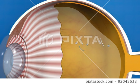 3D illustration medical animated eye anatomy, eye stain formation 92045638