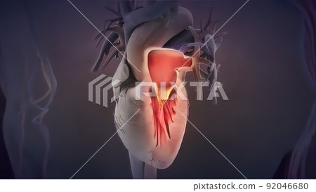 heart valve inflammation 3d medical heart valve inflammation 3d medical 92046680