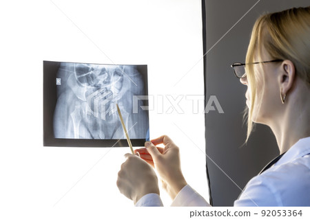 Close up. A female doctor examines an x-ray before surgery. 92053364