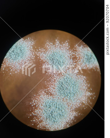 A photo that clearly shows the growth of Penicillium A photo that clearly shows the growth of Penicillium 92070784