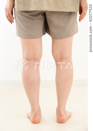 Middle-aged woman in sleeveless summer clothes Middle-aged woman in sleeveless summer clothes 92077420