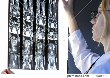 A young female doctor examines an MRI of a patient's brain and spine. Selective focus. A young female doctor examines an MRI of a patient's brain and spine. Selective focus. 92080985