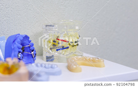Dental model of the tooth jaw with metal braces and wire 92104798