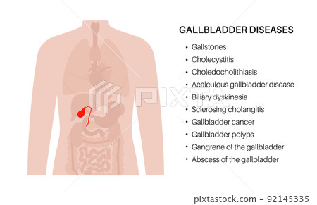 gallbladder anatomy poster 92145335