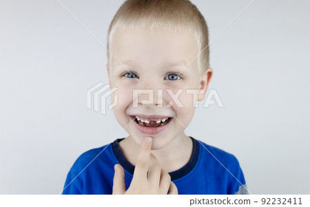 Before and after. Falling out milk tooth. Blond boy in photo has a loose milk tooth, and in other image it has already fallen out. An empty space in place of front teeth. Loss of milk teeth Before and after. Falling out milk tooth. Blond boy in photo has a loose milk tooth, and in other image it has already fallen out. An empty space in place of front teeth. Loss of milk teeth 92232411