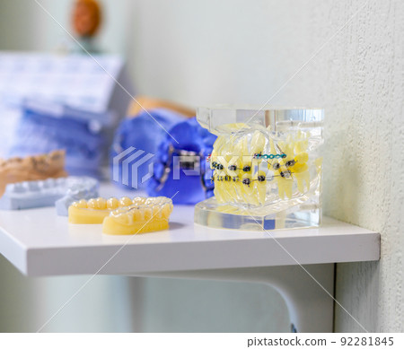 Dental model of the tooth jaw with metal braces and wire 92281845