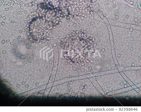Micrograph of mucor 92398646