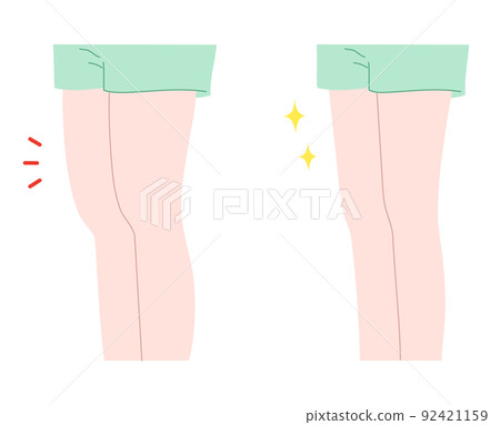Illustration material of a woman with a thick thigh and a woman with a thin thigh Illustration material of a woman with a thick thigh and a woman with a thin thigh 92421159
