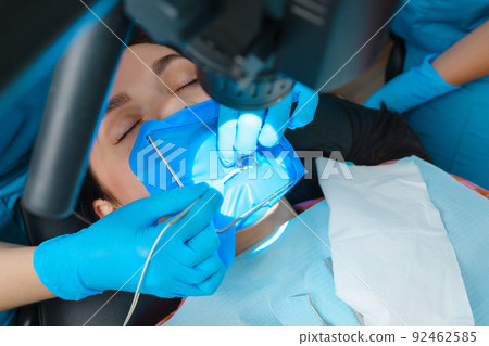 Photo endodontic treatment of dental canals 92462585