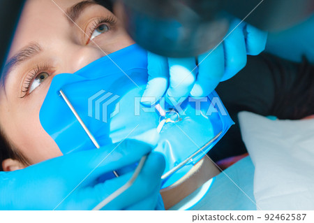 Photo endodontic treatment of dental canals Photo endodontic treatment of dental canals 92462587