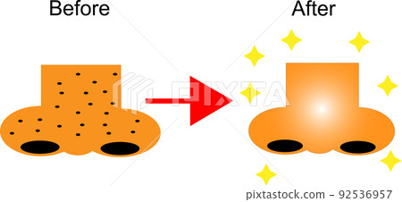 Nose skin care before and after 92536957