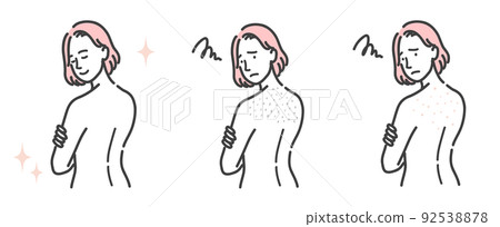 A set of young women suffering from back skin problems 92538878