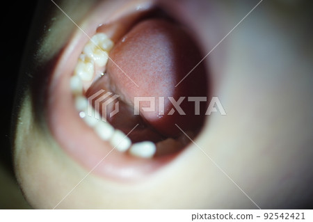 Oral cavity 92542421