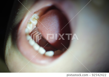 Oral cavity 92542422