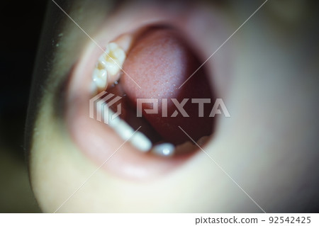 Oral cavity 92542425
