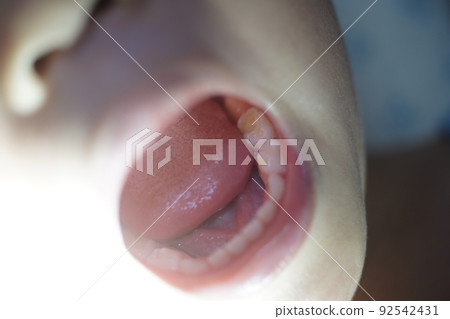口腔 口腔 92542431