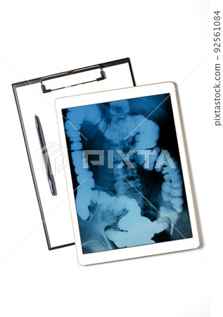 X-ray image of the intestine in the tablet. The concept of telemedicine and diagnosis of diseases X-ray image of the intestine in the tablet. The concept of telemedicine and diagnosis of diseases 92561084