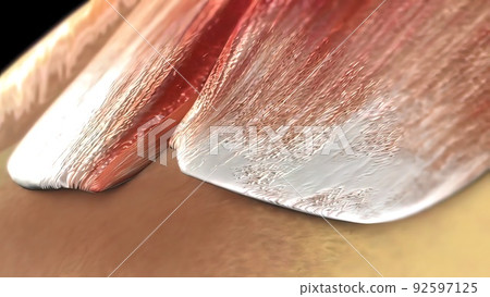 The humeral head is the articular surface of the upper extremity, which is hemispherical. The humeral head is the articular surface of the upper extremity, which is hemispherical. 92597125