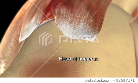 The humeral head is the articular surface of the upper extremity, which is hemispherical. The humeral head is the articular surface of the upper extremity, which is hemispherical. 92597171