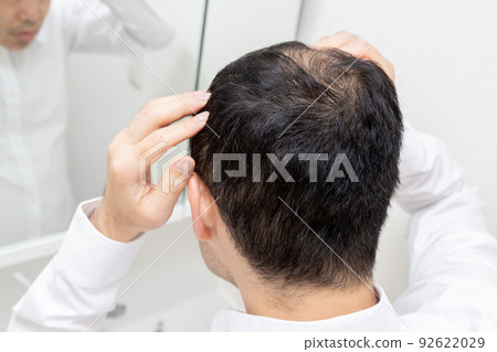 中年男子遭受稀薄的頭髮 92622029