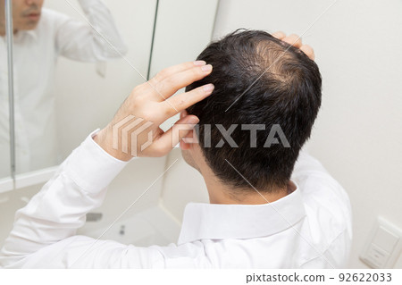 中年男子遭受稀薄的頭髮 92622033
